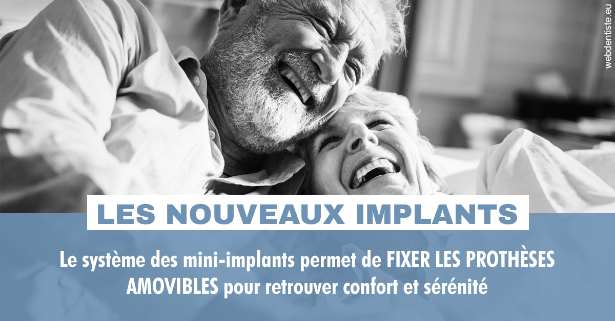 https://www.docteurfournier.fr/Les nouveaux implants 2
