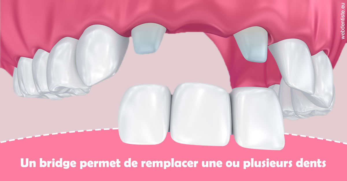 https://www.docteurfournier.fr/Bridge remplacer dents 2