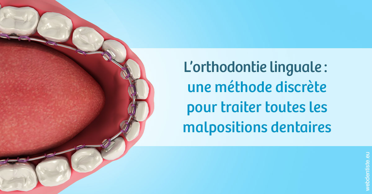 https://www.docteurfournier.fr/L'orthodontie linguale 1