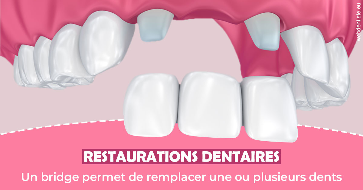 https://www.docteurfournier.fr/Bridge remplacer dents 2