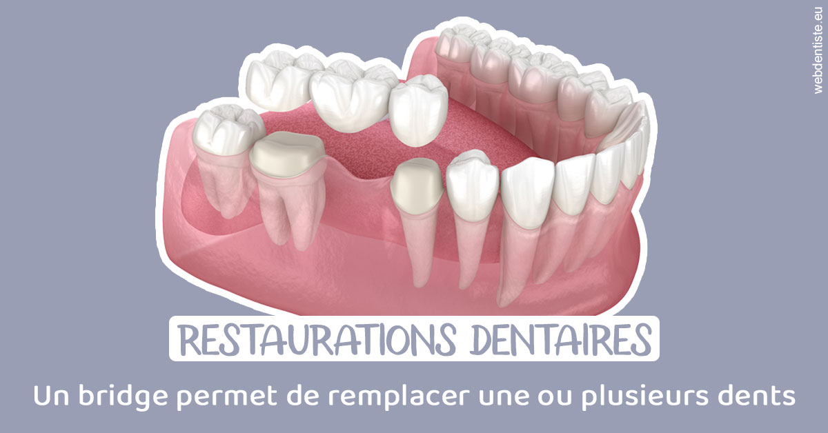 https://www.docteurfournier.fr/Bridge remplacer dents 1