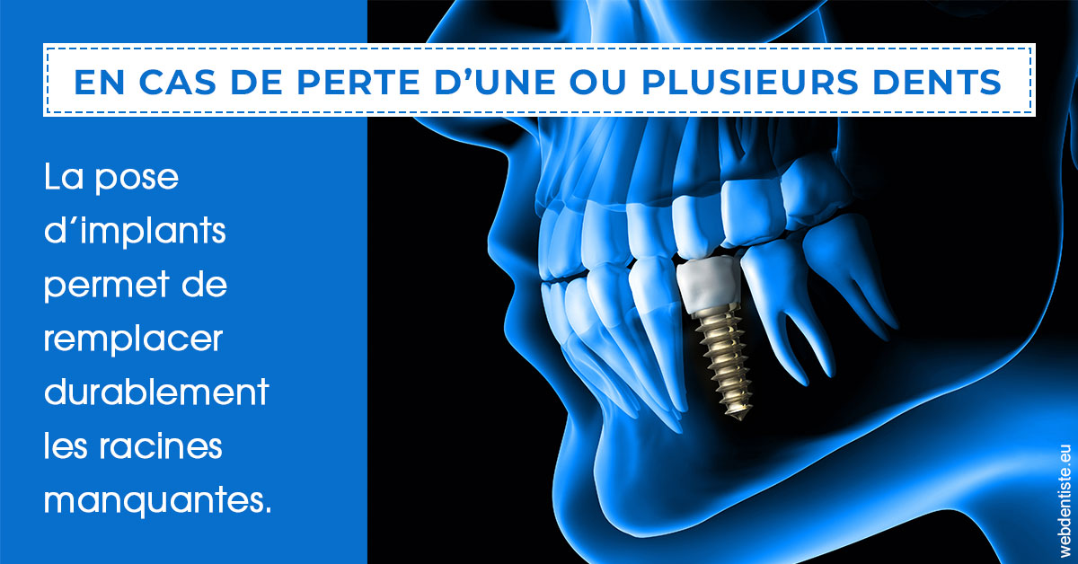 https://www.docteurfournier.fr/2024 T1 - Implants 01