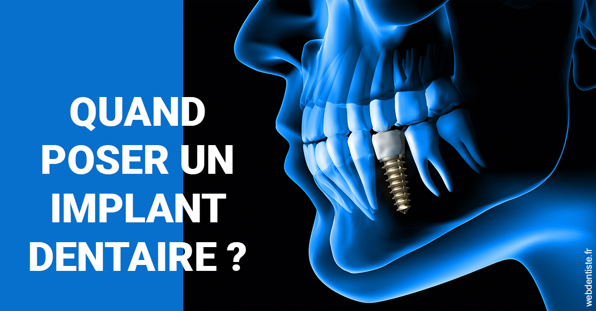 https://www.docteurfournier.fr/Les implants 1