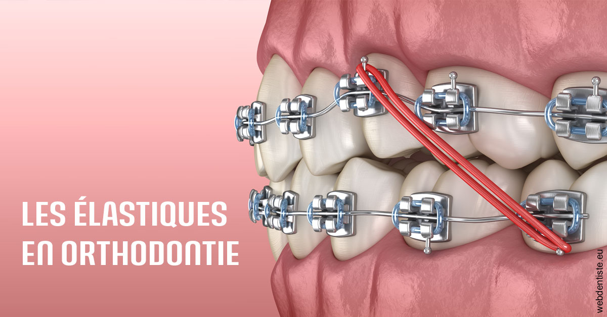 https://www.docteurfournier.fr/Elastiques orthodontie 2