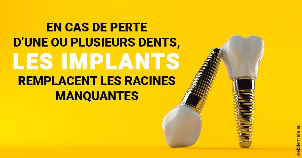 https://www.docteurfournier.fr/Les implants 2
